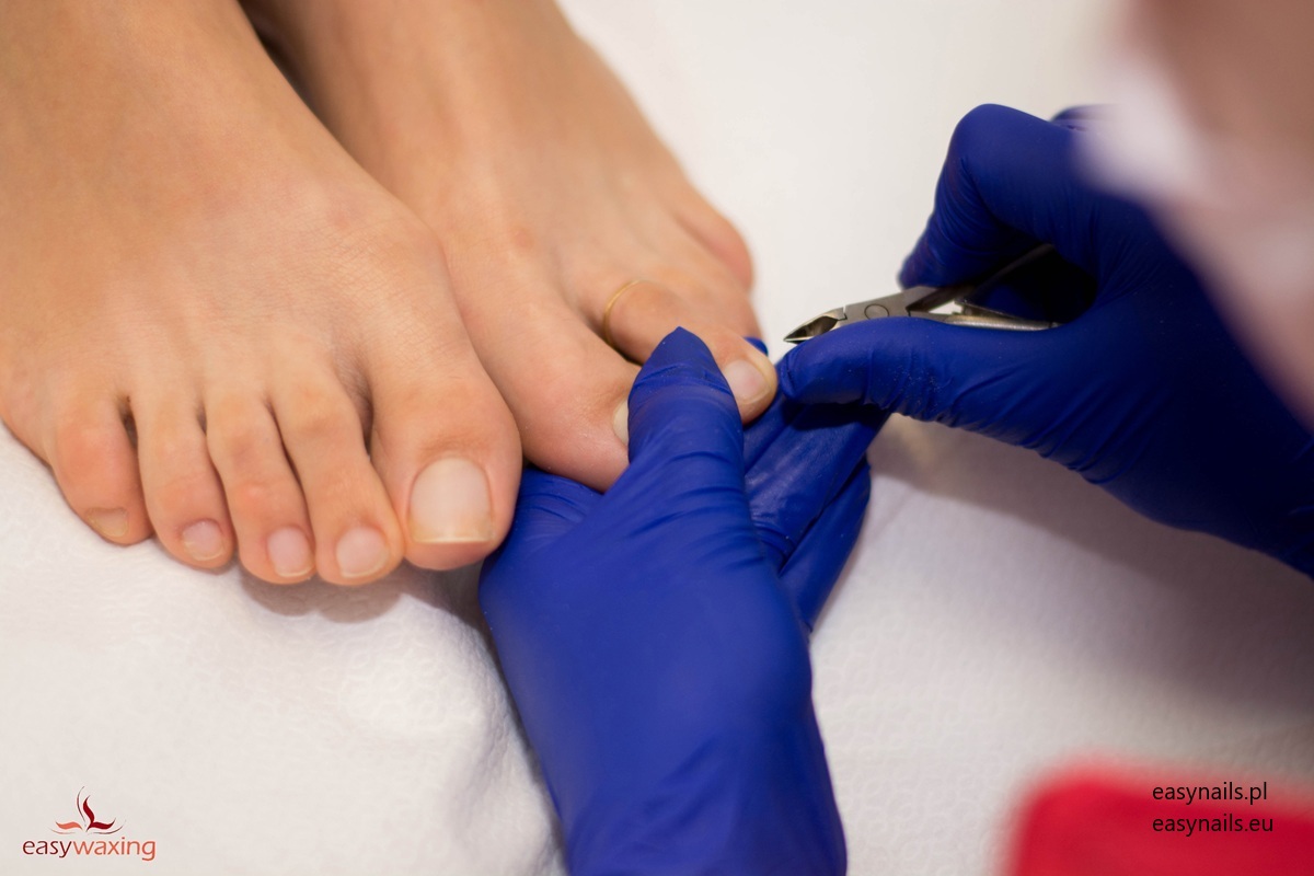 Jak Poprawnie Skracać Paznokcie U Stóp, By Uniknąć Wrastania