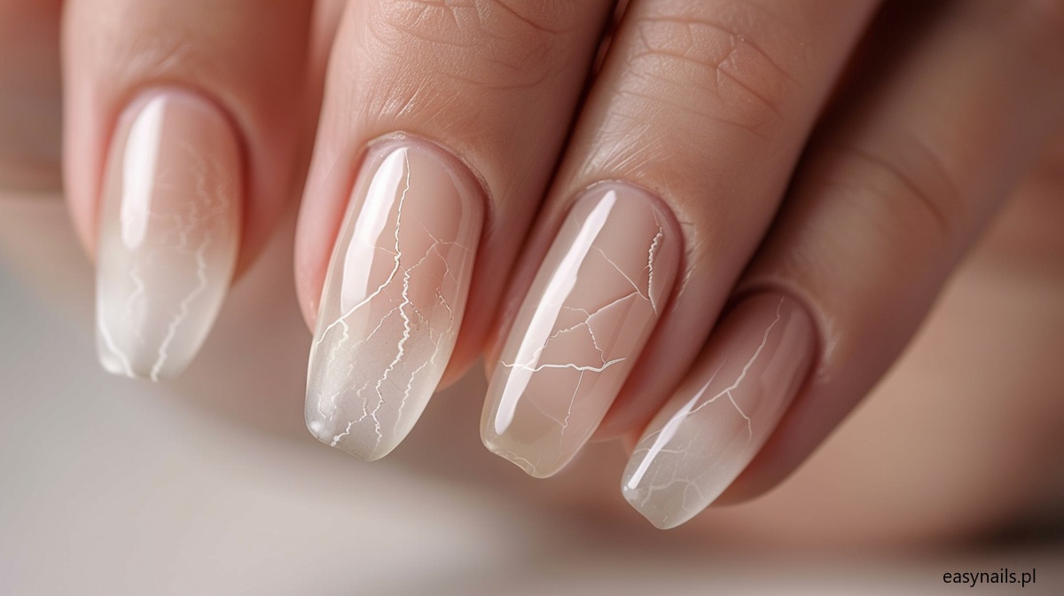 Najczęstsze Choroby Paznokci – Jak Je Rozpoznać Objawy Grzybicy I Innych Chorób Paznokci?